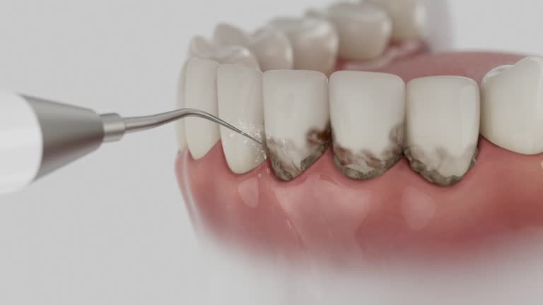 Reliable Tooth Extraction contractor in West Hazleton, PA by Smile Center Dentistry